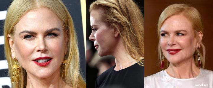 Nicole Kidman's Ears: Journey Through Hollywood's Spotlight